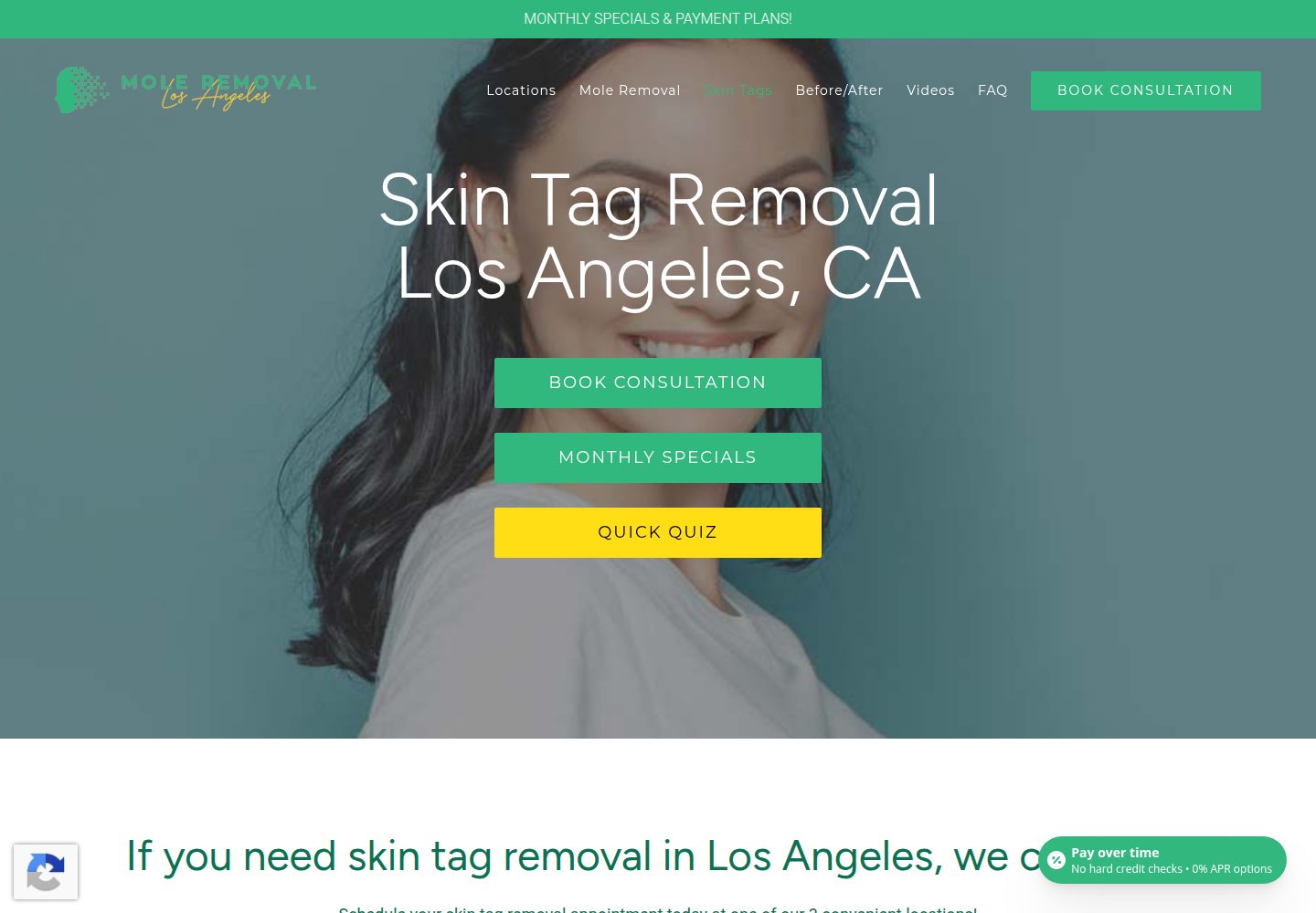 Skin Tag Removal Los Angeles website screenshot